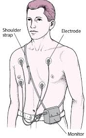 Holter ECG Monitor Market Size, Status, Growth | Industry Analysis Report 2020-2028