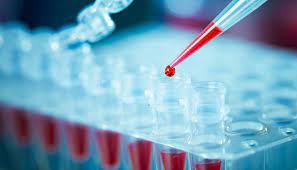 In-Vitro Toxicology Testing Market 2022 | Industry Demand, Fastest Growth, Opportunities Analysis and Forecast To 2028