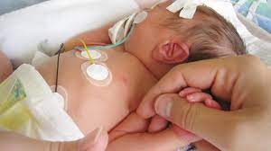 Neonatal Infant Care Market Size, In-depth Analysis Report and Global Forecast to 2028