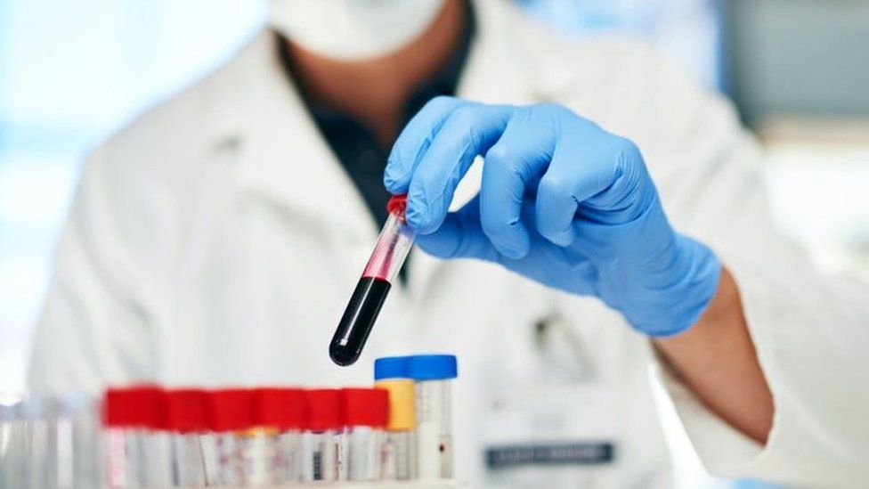 What are the benefits of taking a lab test at home? 