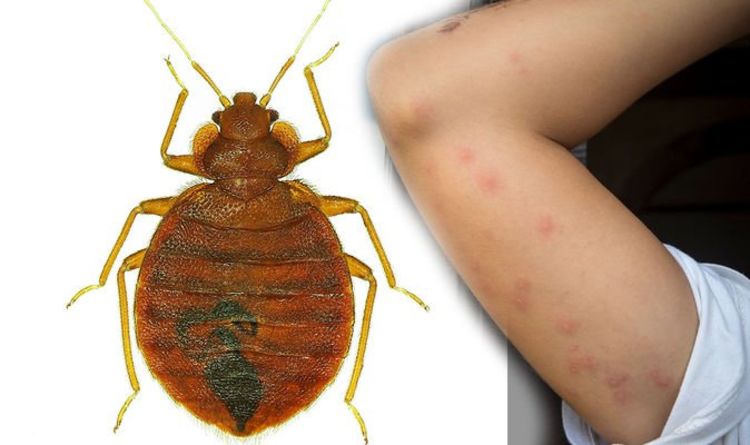 BED BUGS ON CLOTHES – HOW TO REMOVE THEM?
