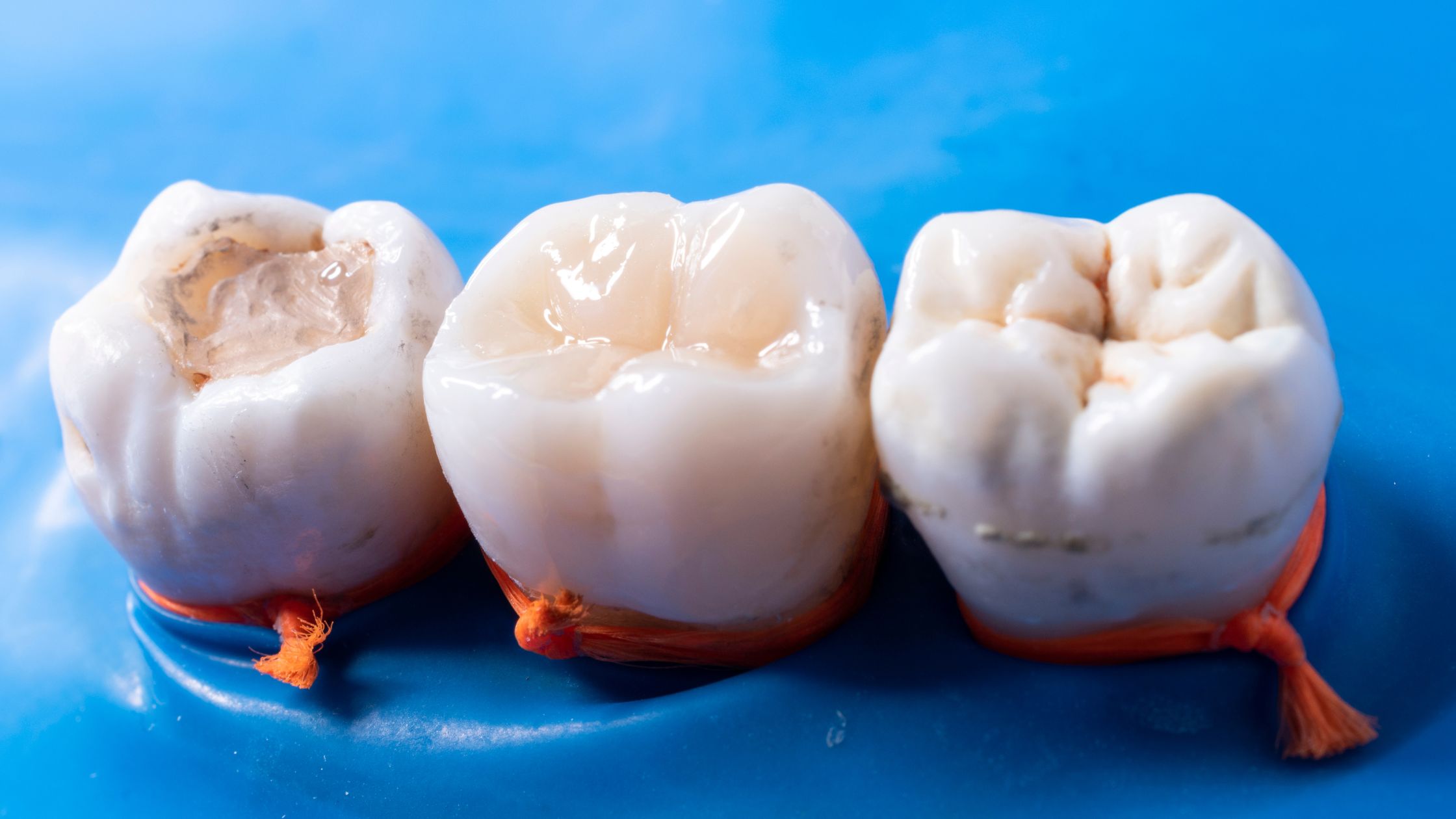 Enamel Erosion: How it Affects Your Teeth?