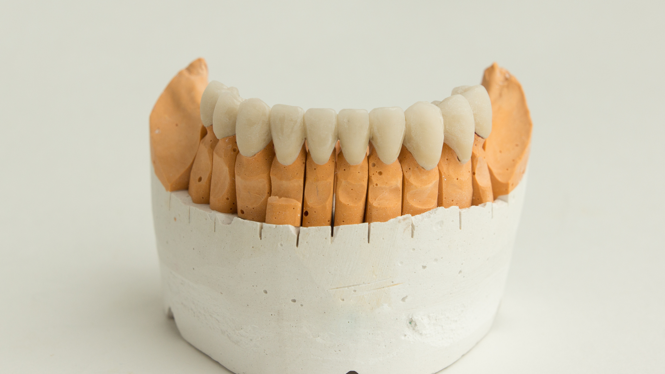 Temporary Crown vs. Permanent Crown: What’s The Difference?