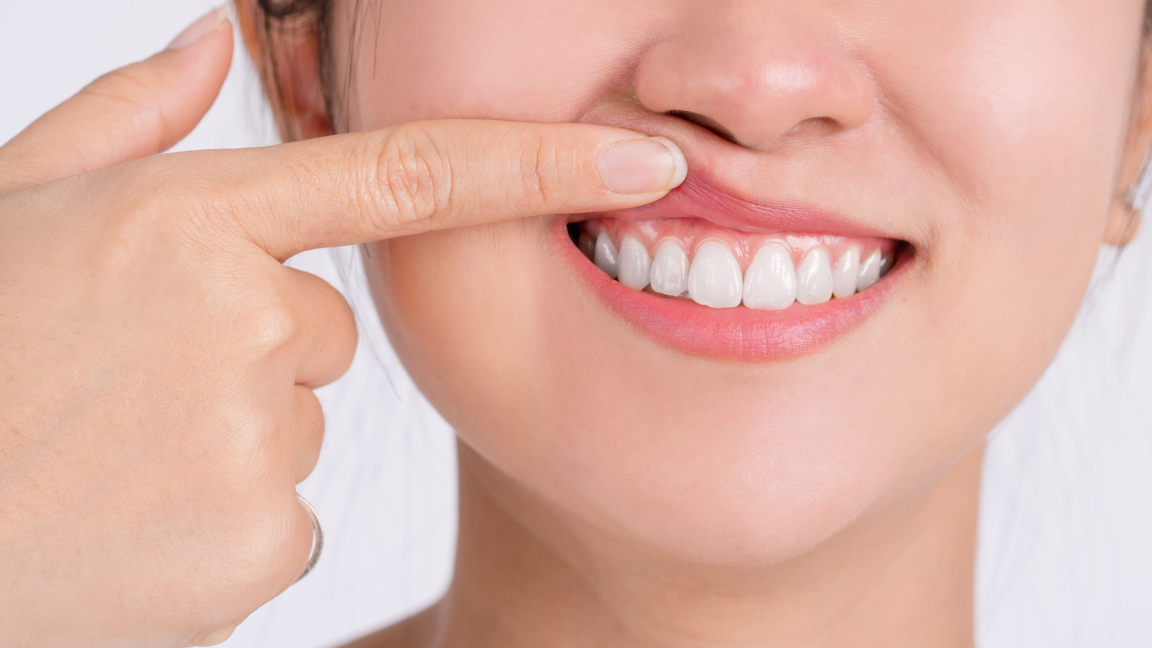 Dental Abscess- Diagnosis and Treatment