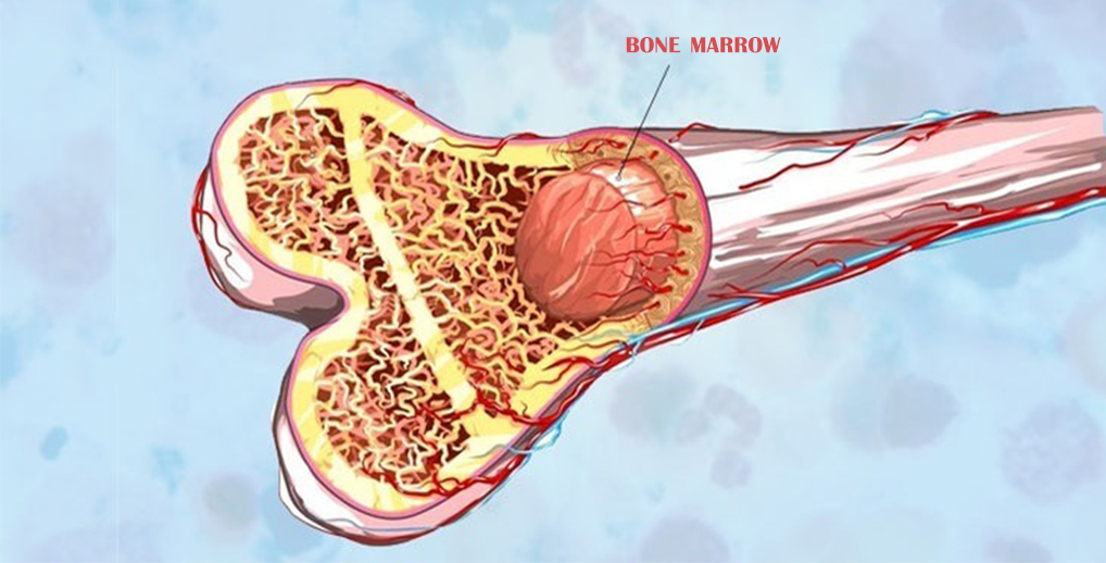 A Radical Solution: Stem Cell Bone Marrow Transplant in Delhi