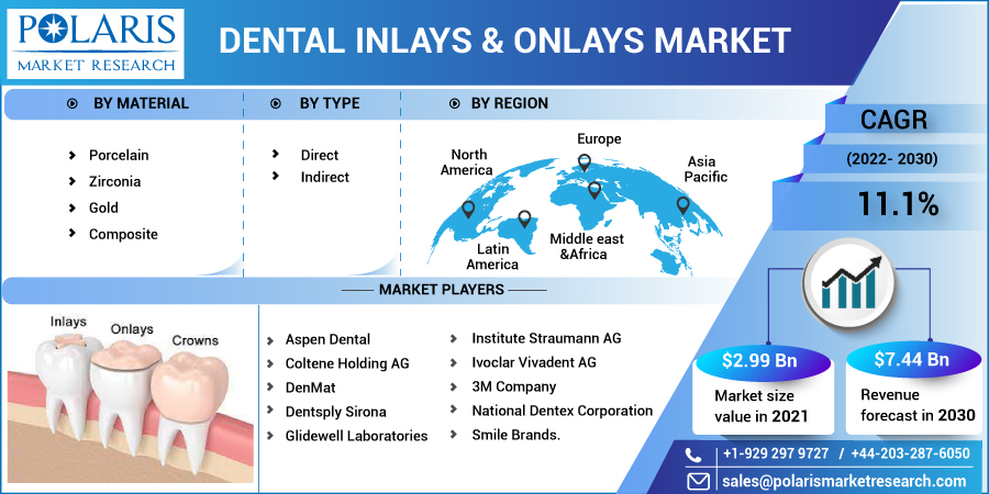 Dental Inlays & Onlays Market Major Factors That Could Boost the Industry Worldwide by 2032