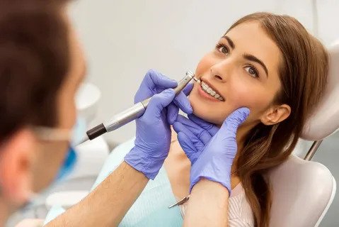 Unlock the Secret to Perfectly Straight Teeth with Hidden Lingual Braces