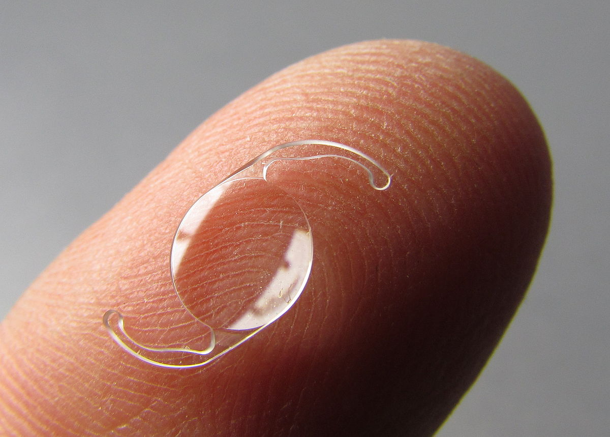 Intraocular Lens Market Size, Status, Top Emerging Trends, Growth and Business Opportunities 2030
