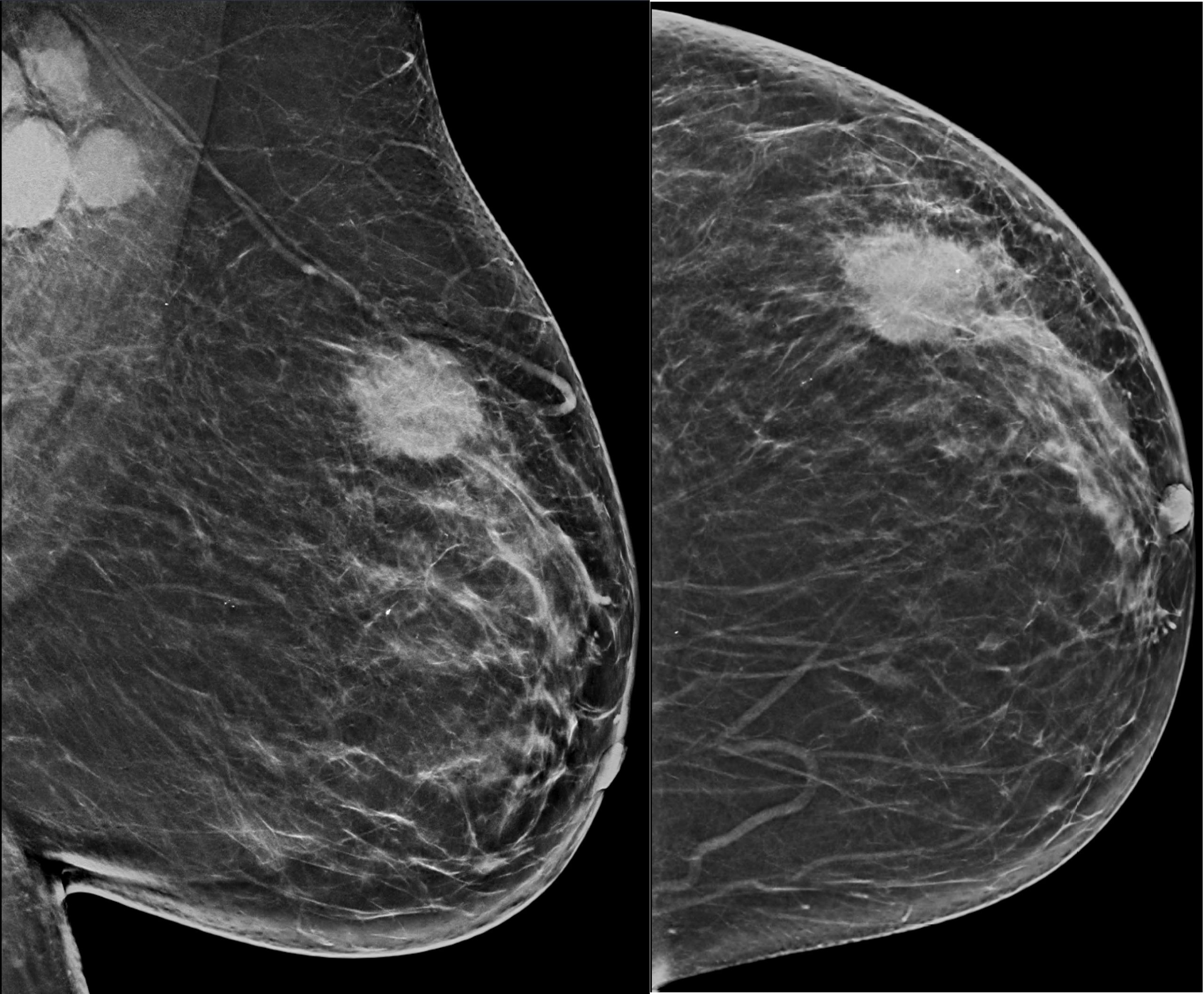 Breast Imaging Market is Estimated To Witness High Growth Owing To Technological Advancements