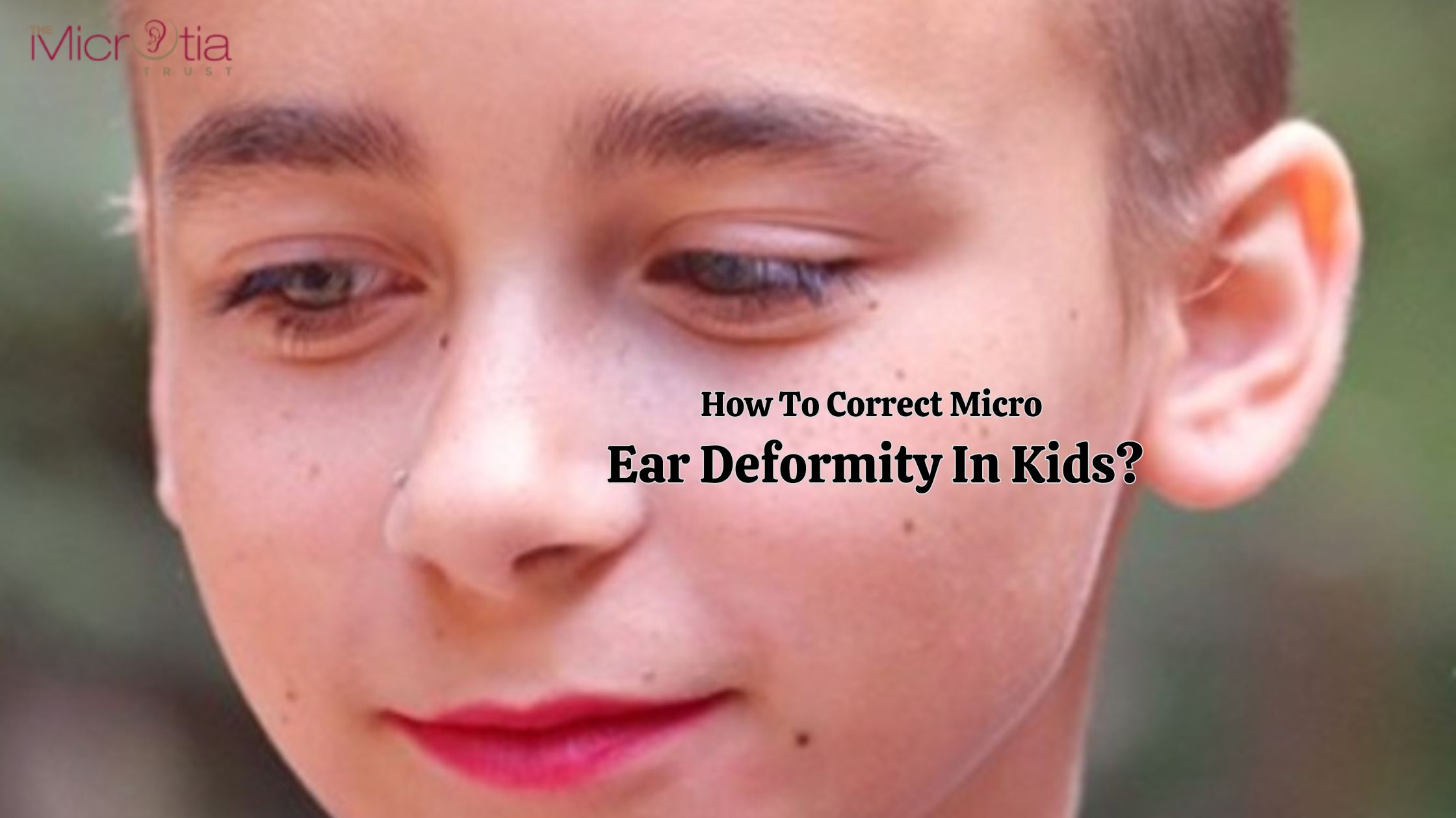 How To Correct Micro Ear Deformity In Kids?