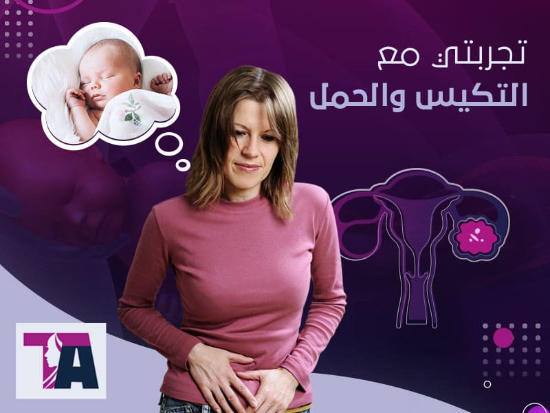 تجربتي مع تكيس المبايض