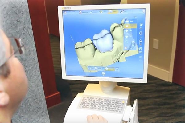 All You Need To Know About Root Canal Treatment