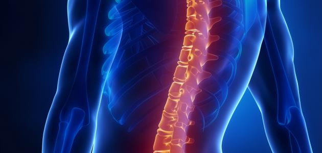 أسباب خشونة الفقرات القطنية