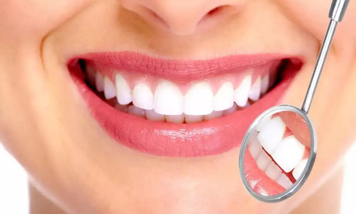 How Do You Find Grants Program for Cosmetic Dental Implants?