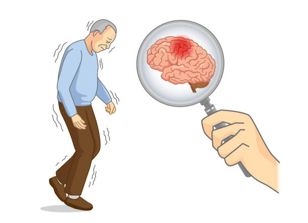 Parkinson's Disease Therapeutics Market Latest Innovations and Trends to Boost Growth during 2027