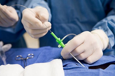Cardiac surgery Instruments Market Current Scope Applications, Types and Future Outlook Report 2027