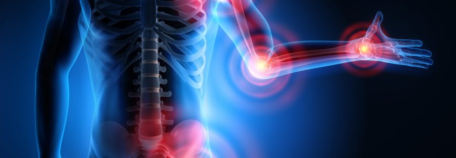 Moral Points for Those Undergoing Shoulder Replacement