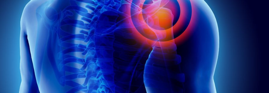 Avoid These After your Shoulder Replacement Surgery