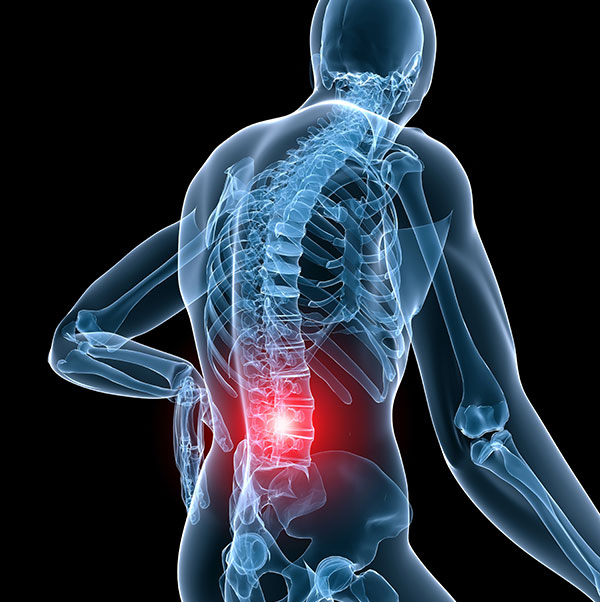 back pain