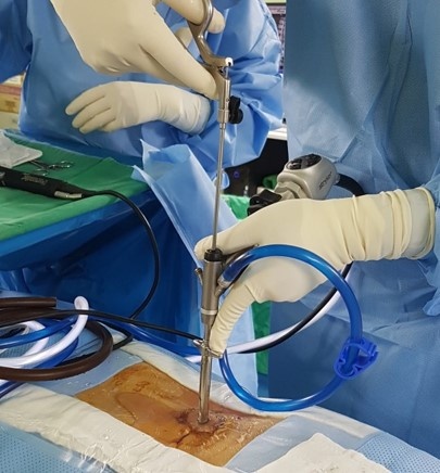 best spine surgeon in Hyderabad