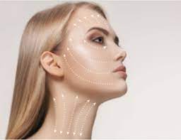 Thread Lifting Sapphire Medical Aesthetics