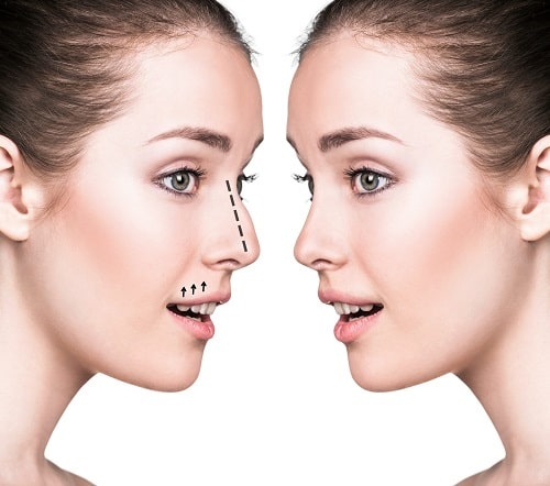 Popular Plastic and Cosmetic Surgeries For Body Contouring