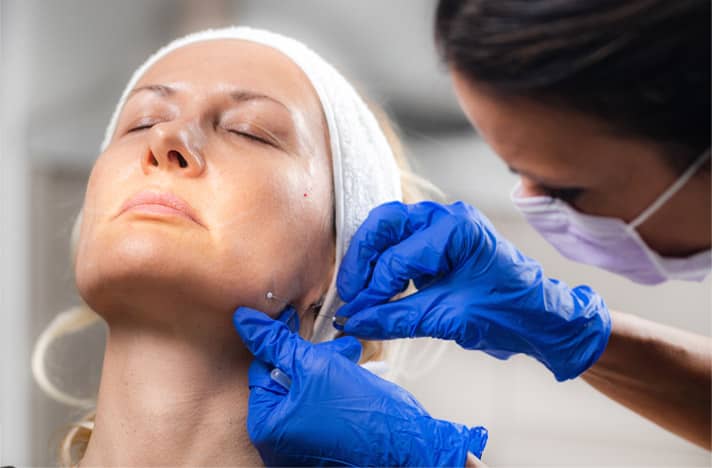 How Facelift Surgery Can Give You A More Youthful Appearance
