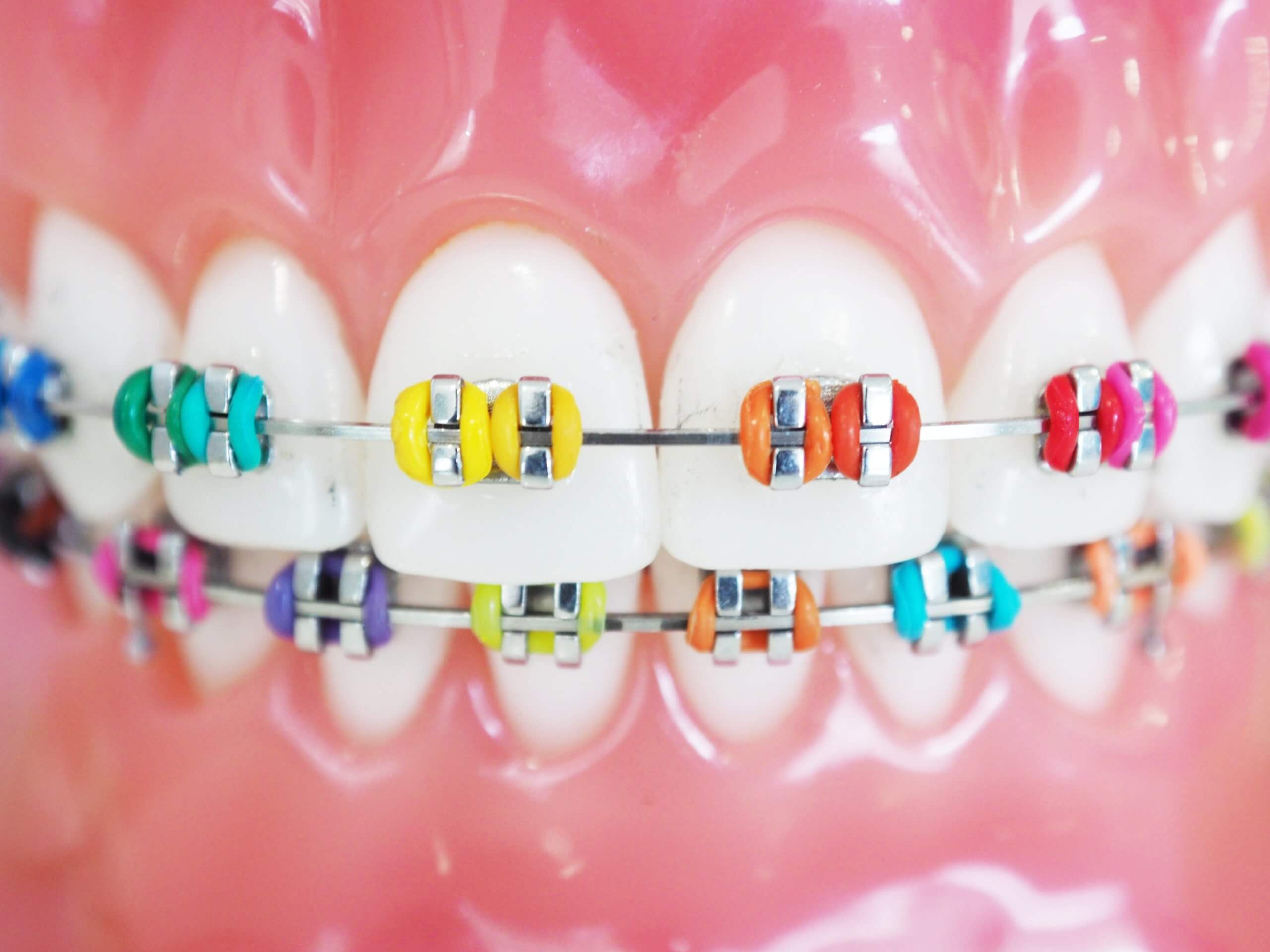 5 Points to Consider When Selecting an Orthodontist