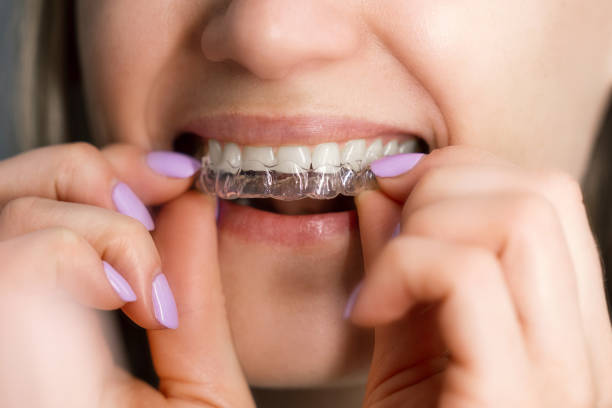 Clear Aligners for a Confident Smile: Exploring Invisalign Treatment Options