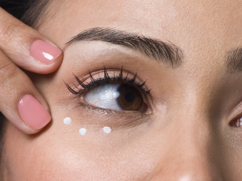 UNDER EYE PIGMENTATION(“DARK CIRCLES”)