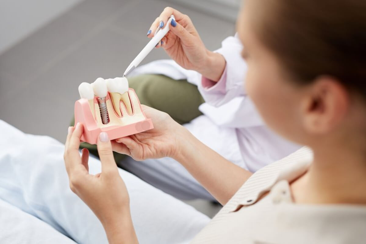 Things You Need to Know About Dental Implants in Red Deer