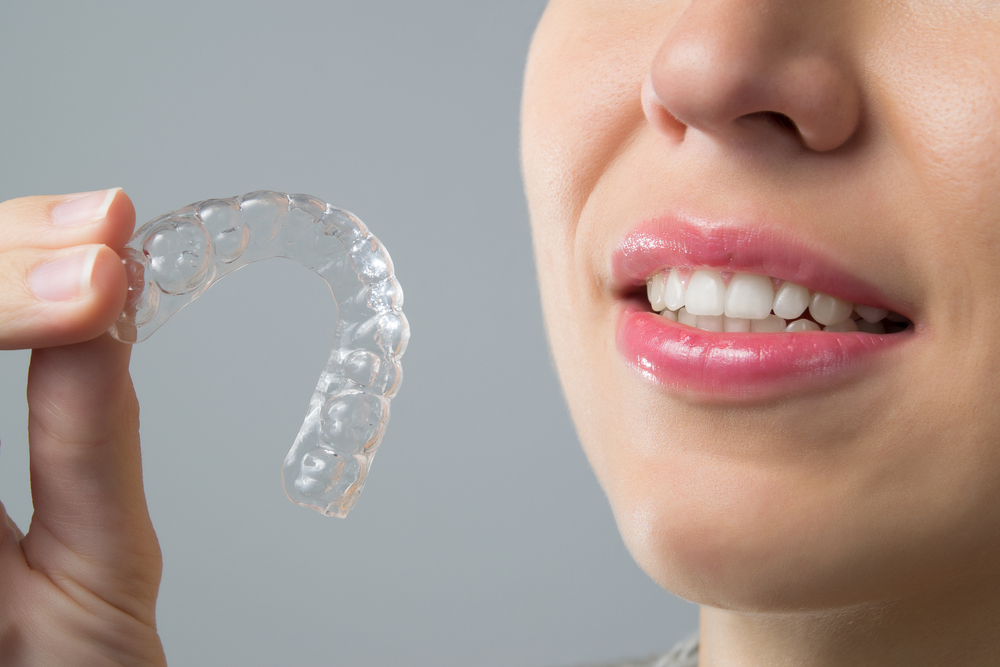 Both Adults and Children Can Wear Invisalign