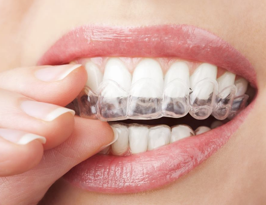 Invisalign Treatment Specialists Moreno Valley