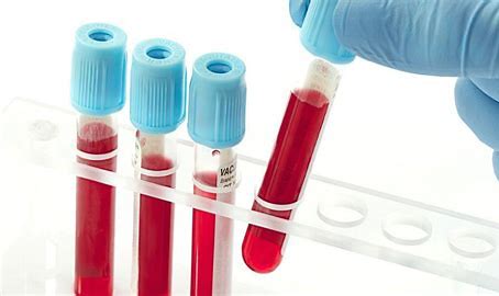 Blood Screening Market 2022 | Industry Demand, Fastest Growth, Opportunities Analysis and Forecast To 2028