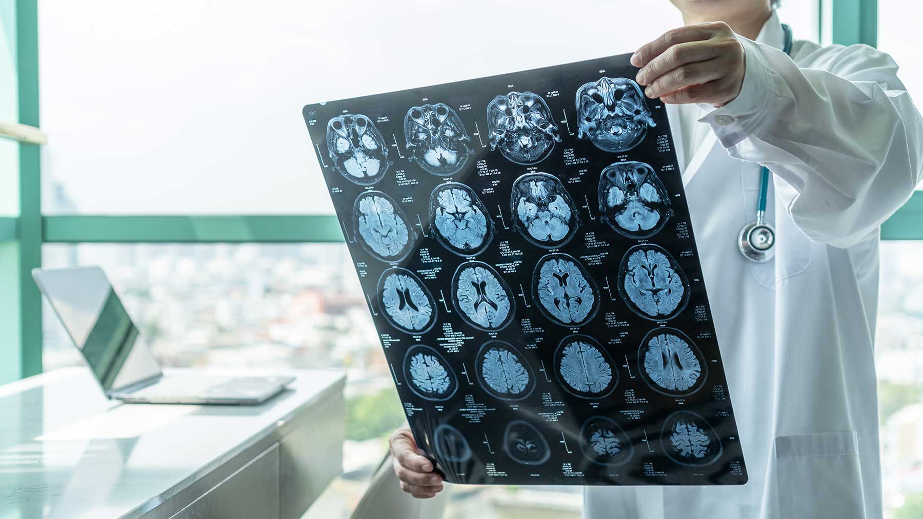 6 Common Symptoms of Known Neurological Disorders