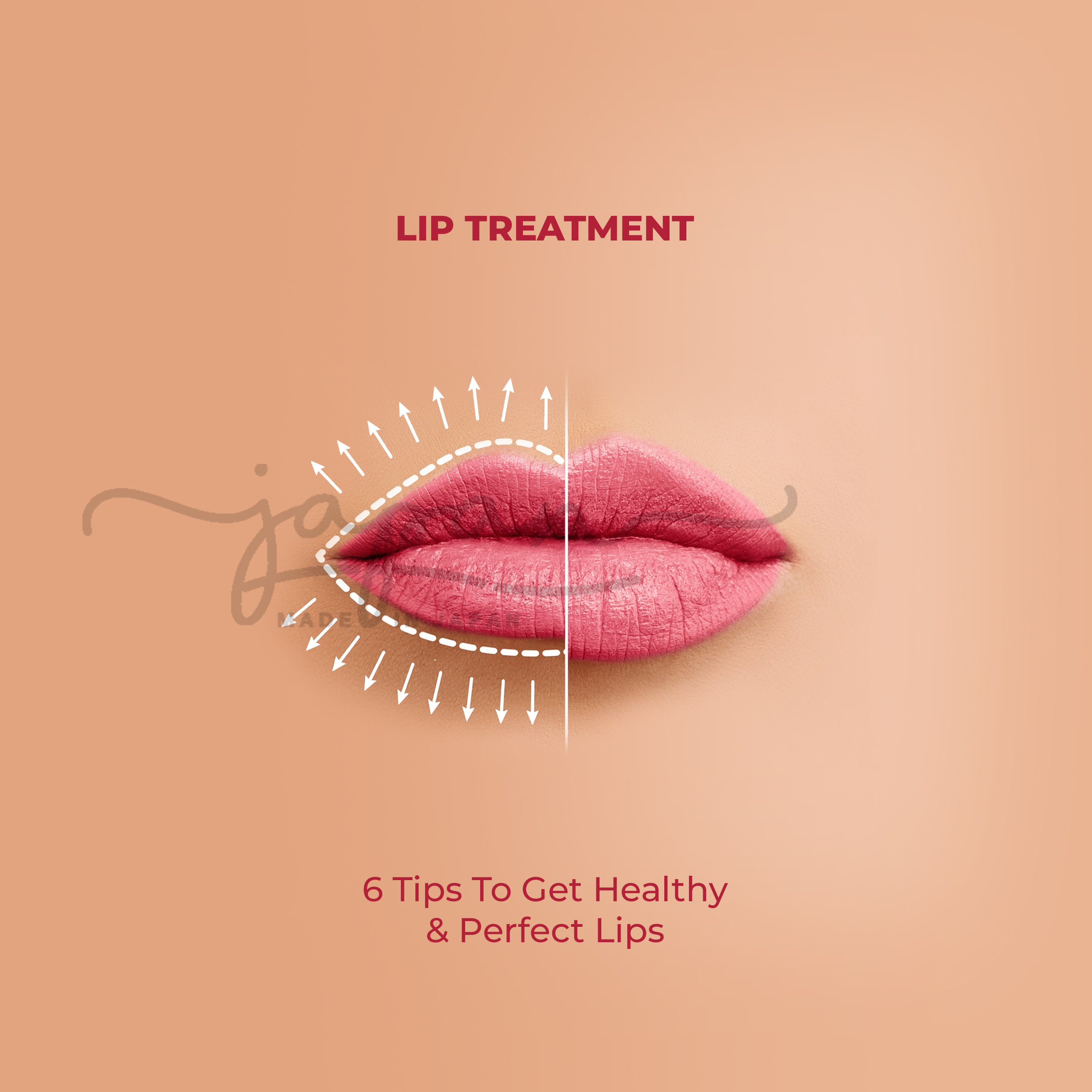 6 Tips To Get Healthy & Perfect Lips