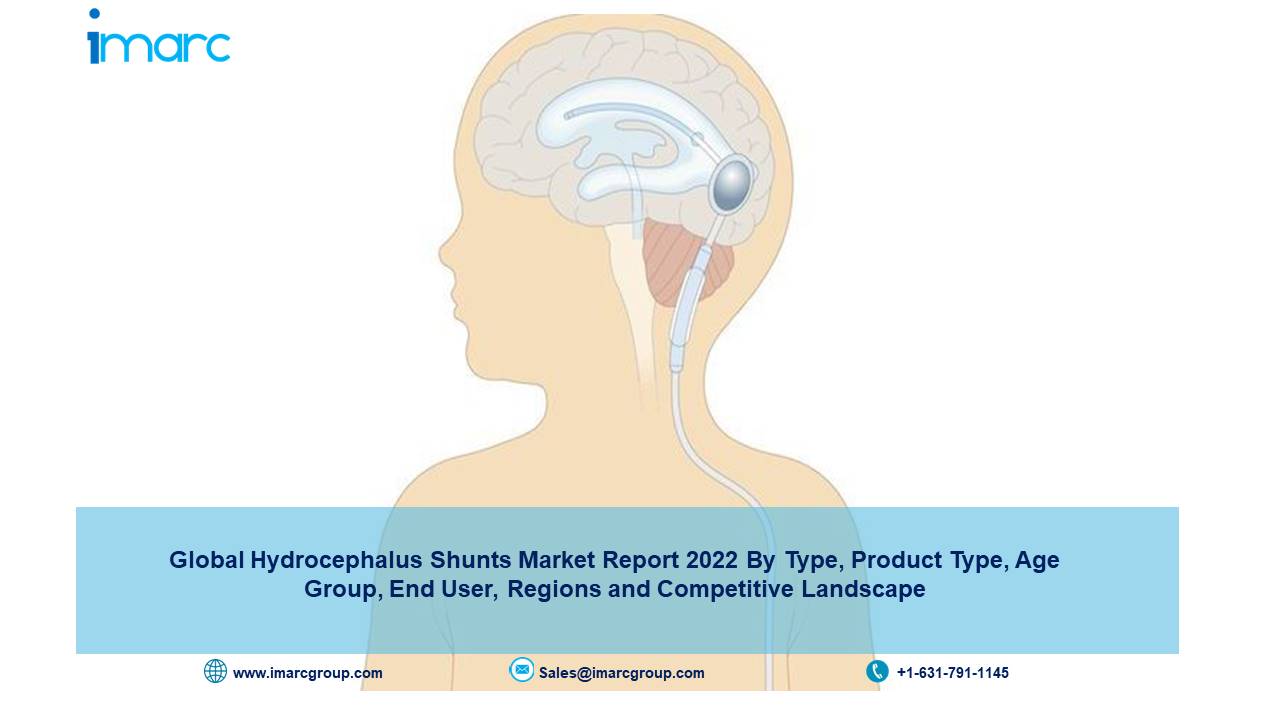 Hydrocephalus Shunts Market - Trends, Share, Size and Growth 2022-2027