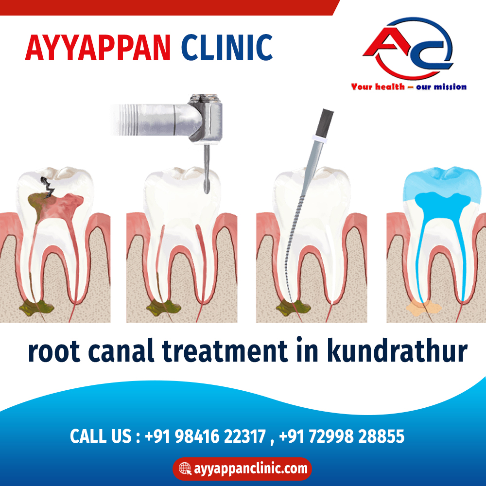 Get Your Roots Stronger