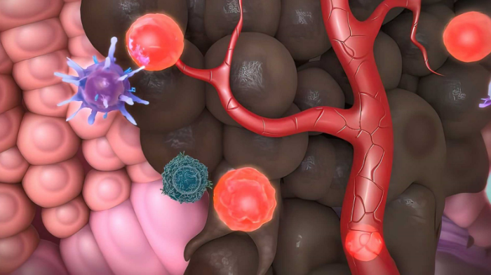 What You Need to Know About Skin Cancer 