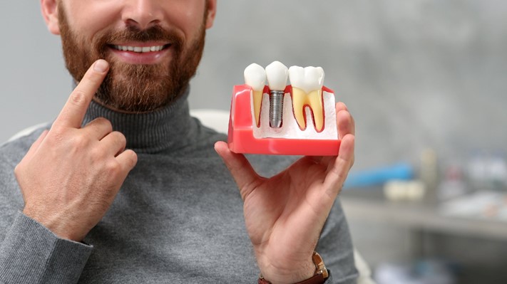 Are Dental Implants the Right Solution for You?