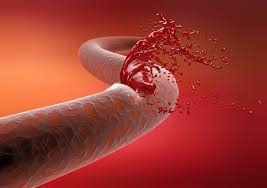 Fc Fusion Protein for Haemophilia Market Size, Share, Regional Overview and Global Forecast to 2028