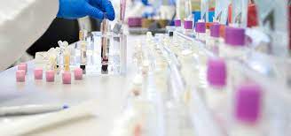 Biobanking Market Size, Share, Growth, Opportunities and Global Forecast to 2028