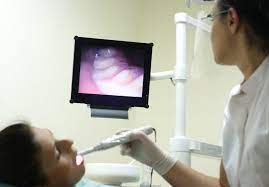 Global Intraoral Cameras Market 2022 - Top Key Players Analysis Report Till 2028