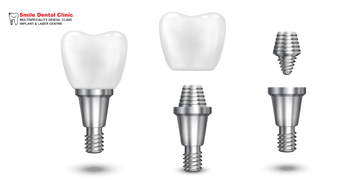 Common Signs You Need Immediate Dental Care