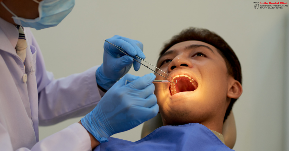Discover Expert Root Canal Treatment Options in Indore