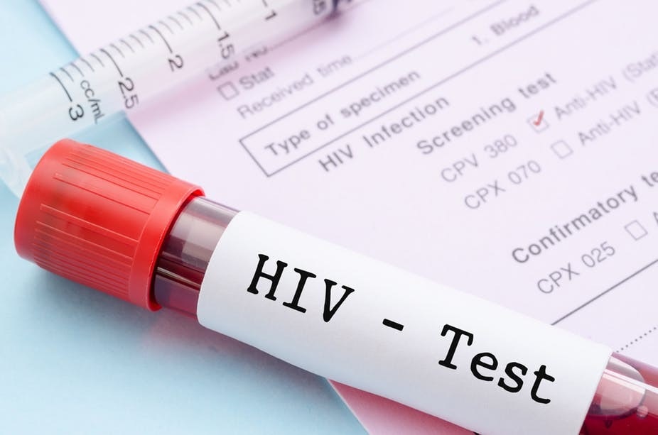 Why consider visiting HIV clinic in Kuala Lumpur?