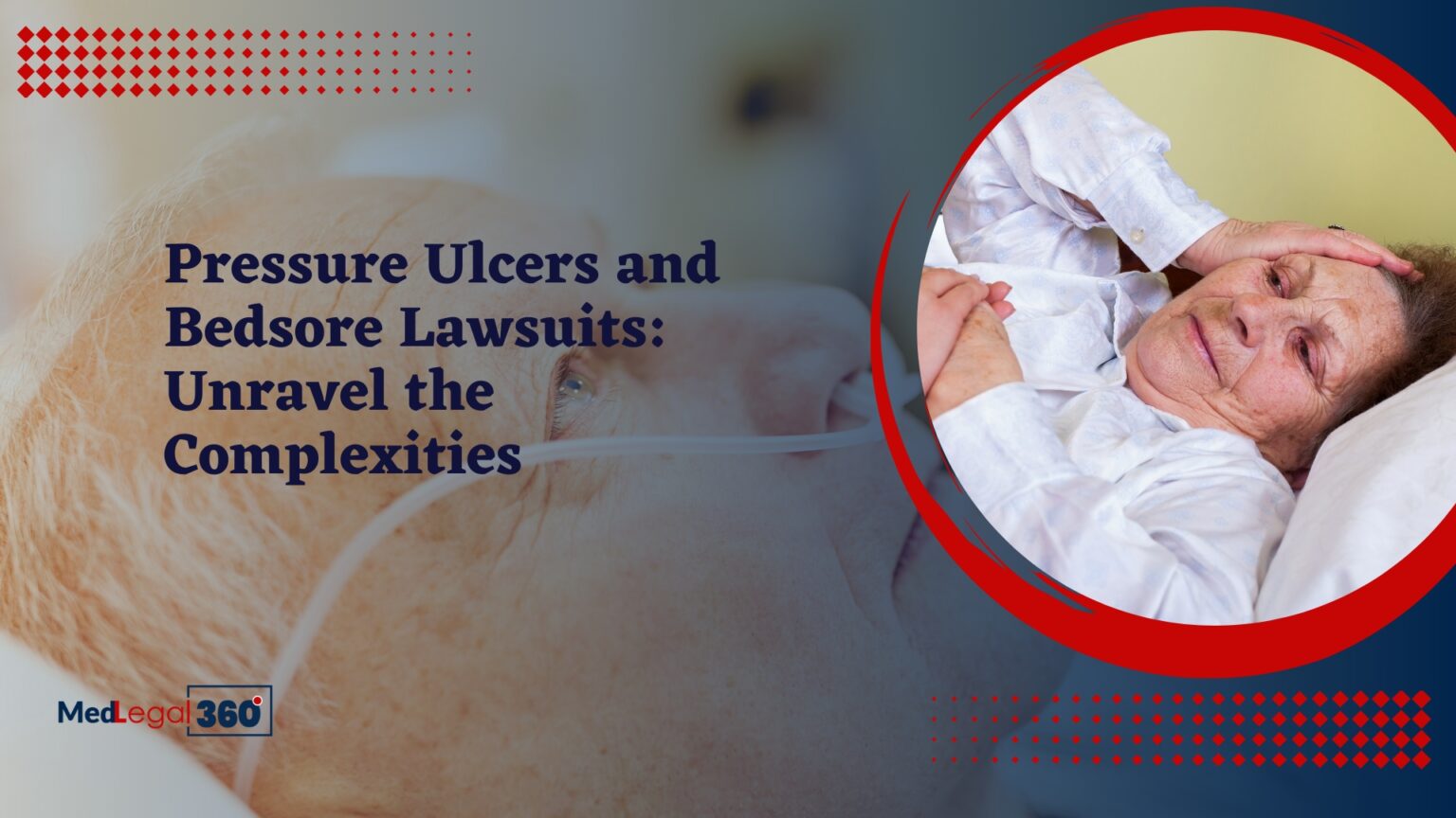 Decoding the Legal Implications of Pressure Ulcers and Bedsore Negligence in Healthcare