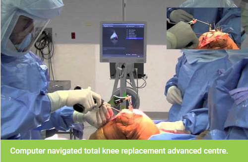  Best knee replacement surgeon in Delhi