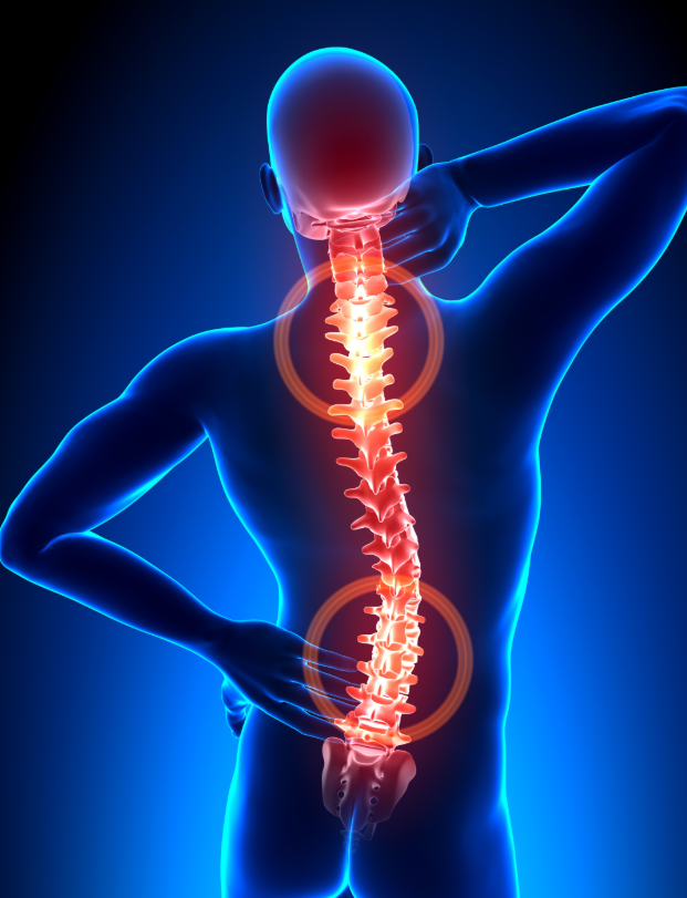 Decompressing the Spine: Understanding Spinal Decompression Surgery in Tampa