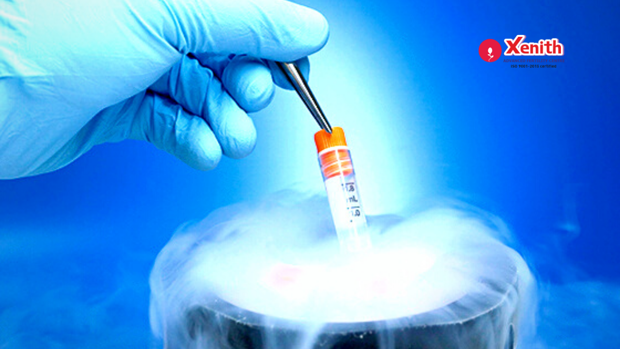 Egg freezing: A Ray of Hope for Cancer Patients to Deal with Infertility